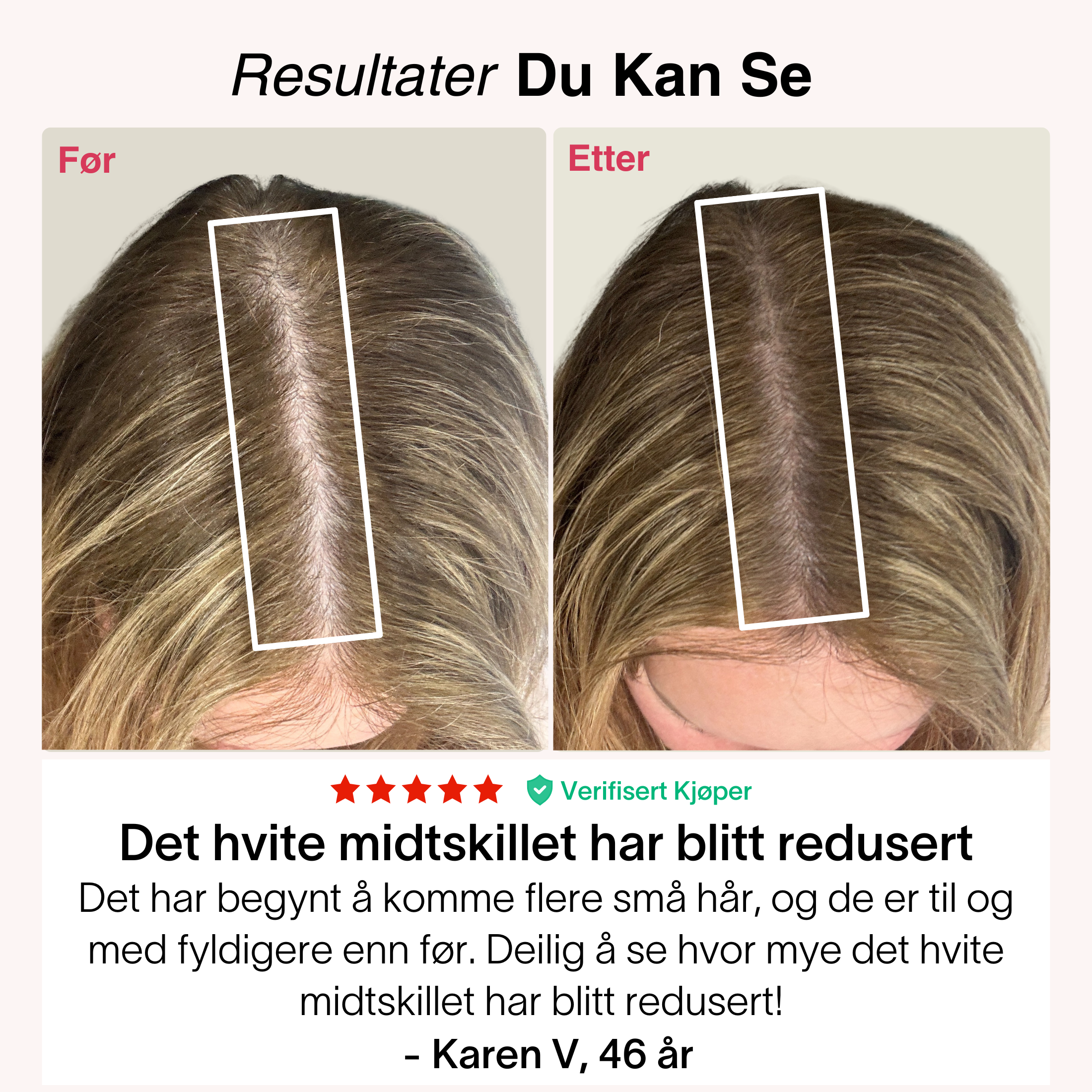 Rødlys-Capsen®
