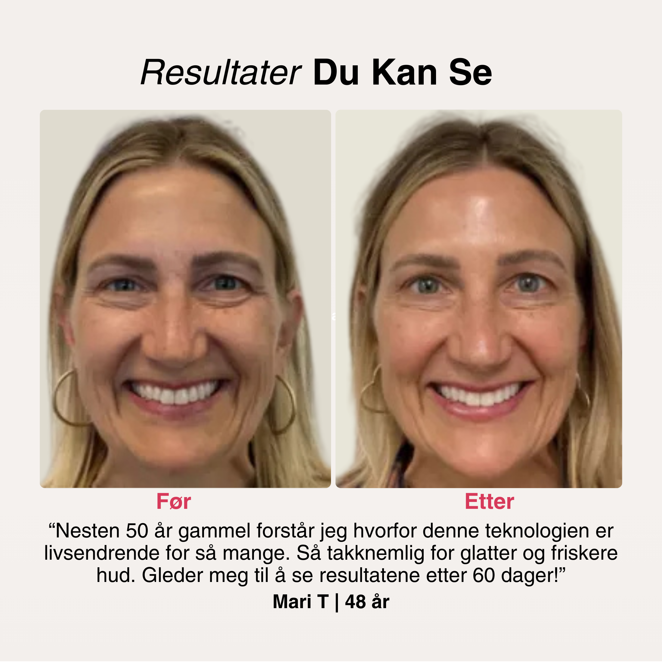 SoftSkin InfraLight® | Ansikt, Hals & Bryst