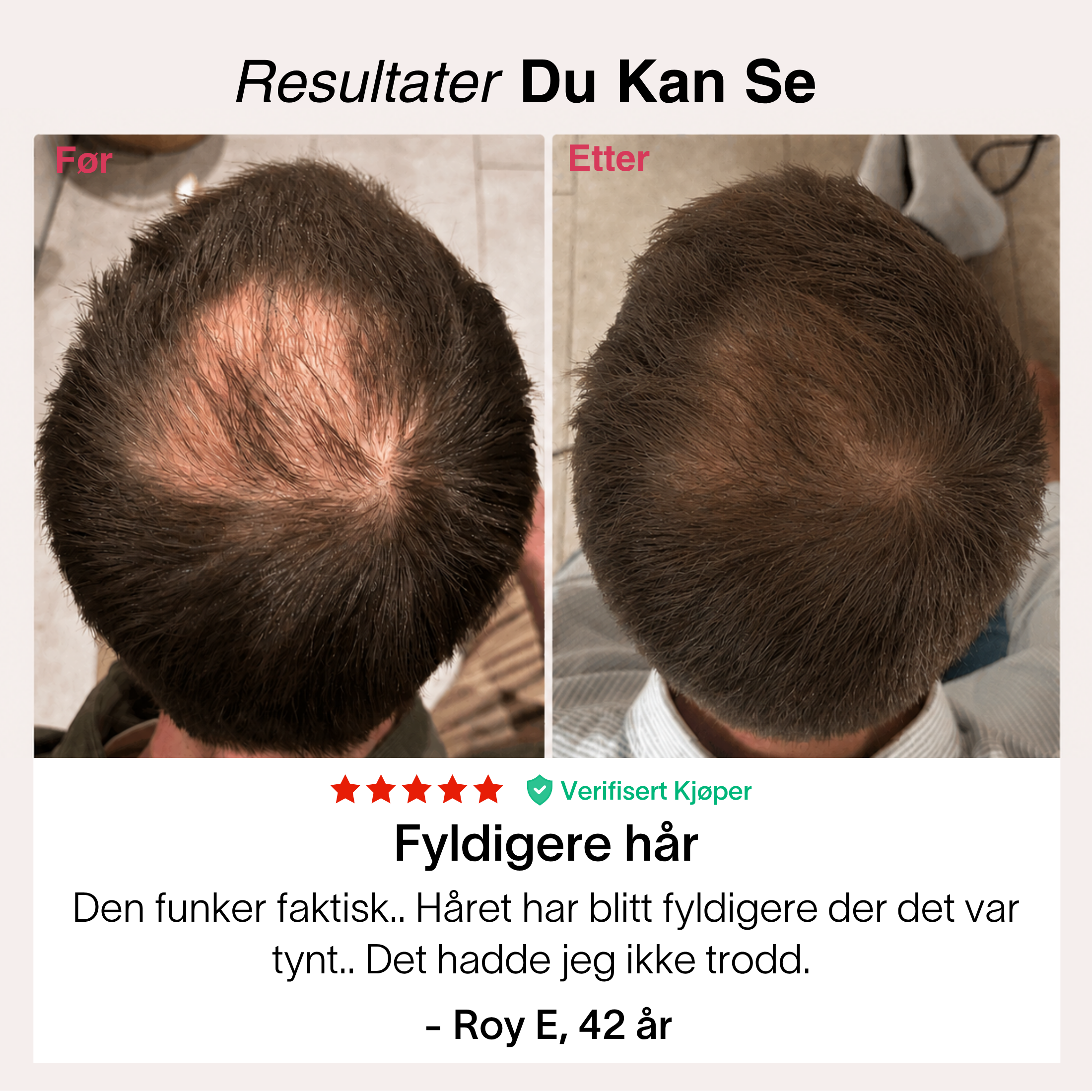Hårvekst-Pakken