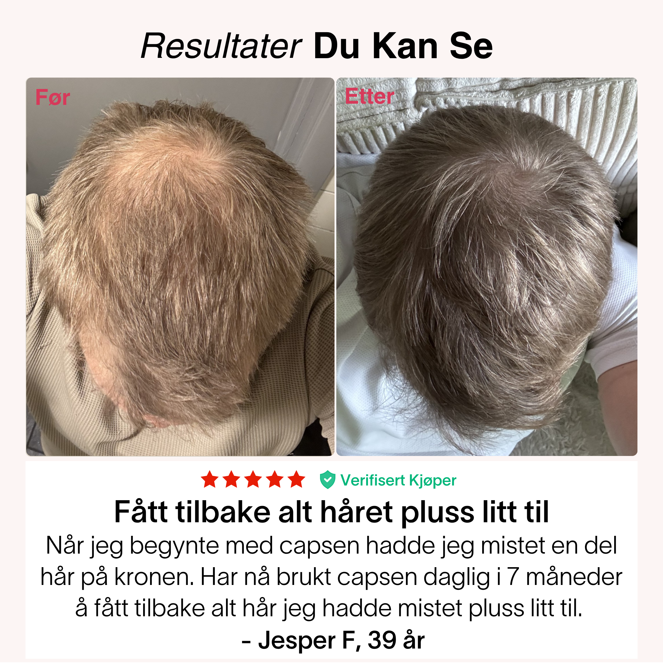 Rødlys-Capsen®