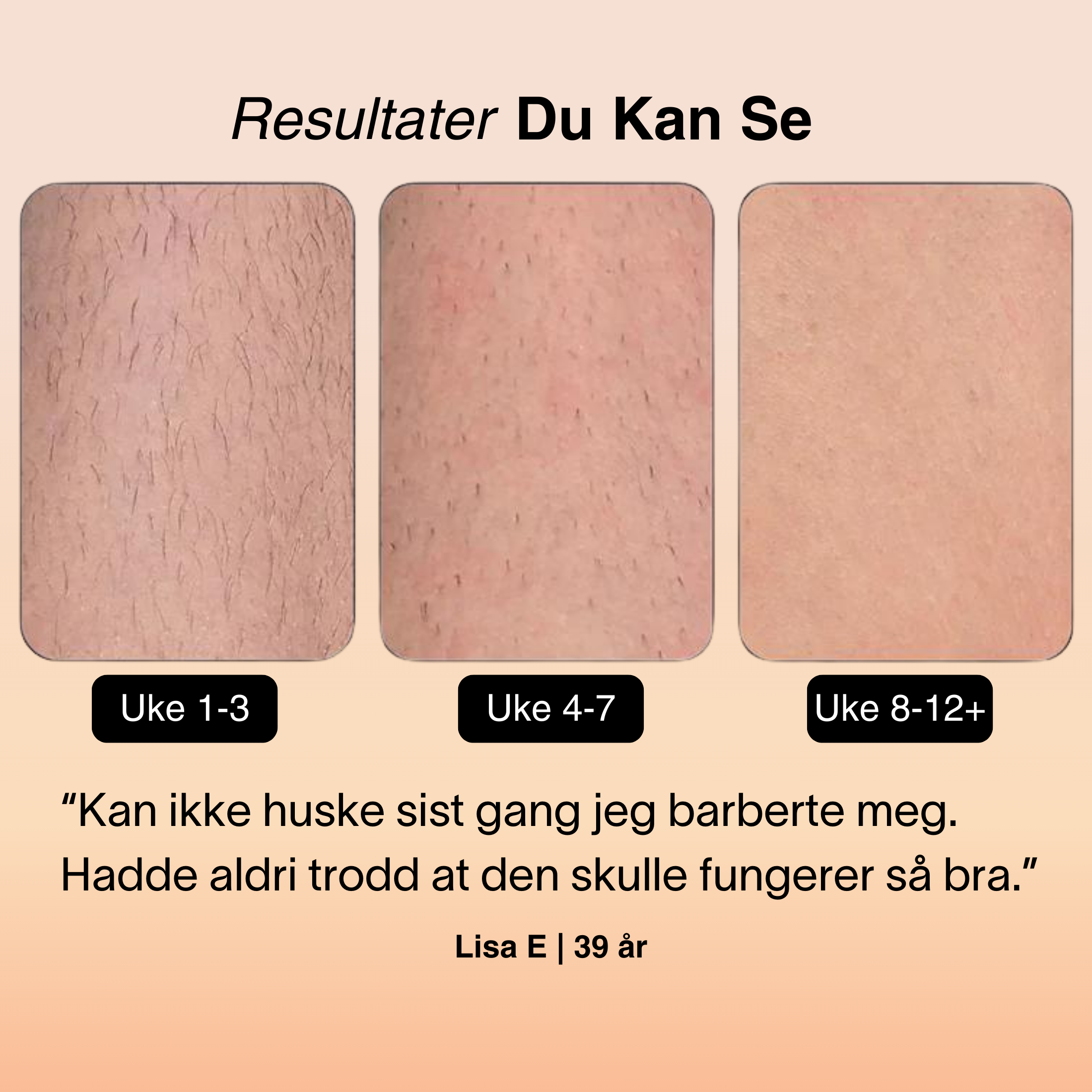 SilkSkin® IPL Hårfjerner