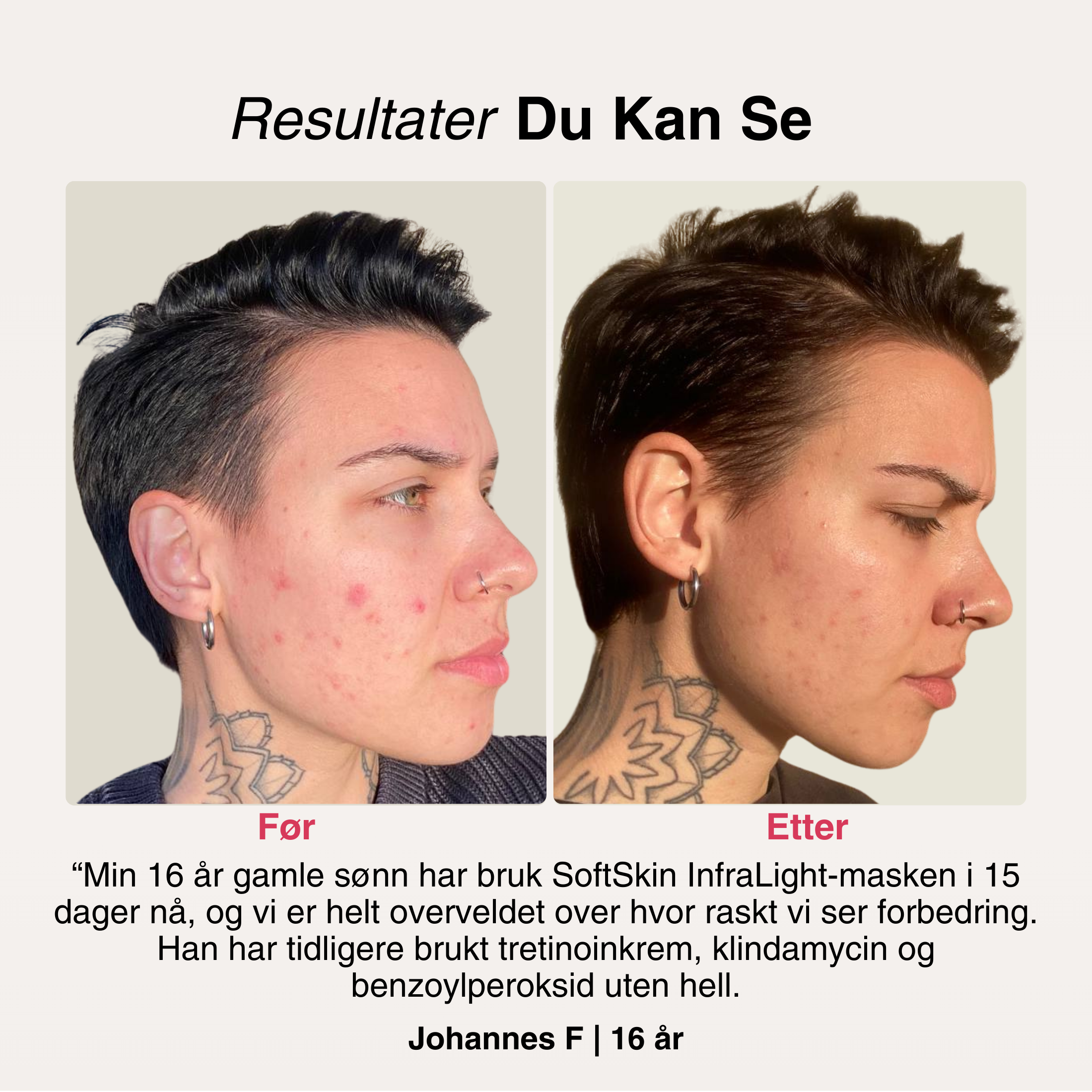 SoftSkin InfraLight® | Ansikt, Hals & Bryst