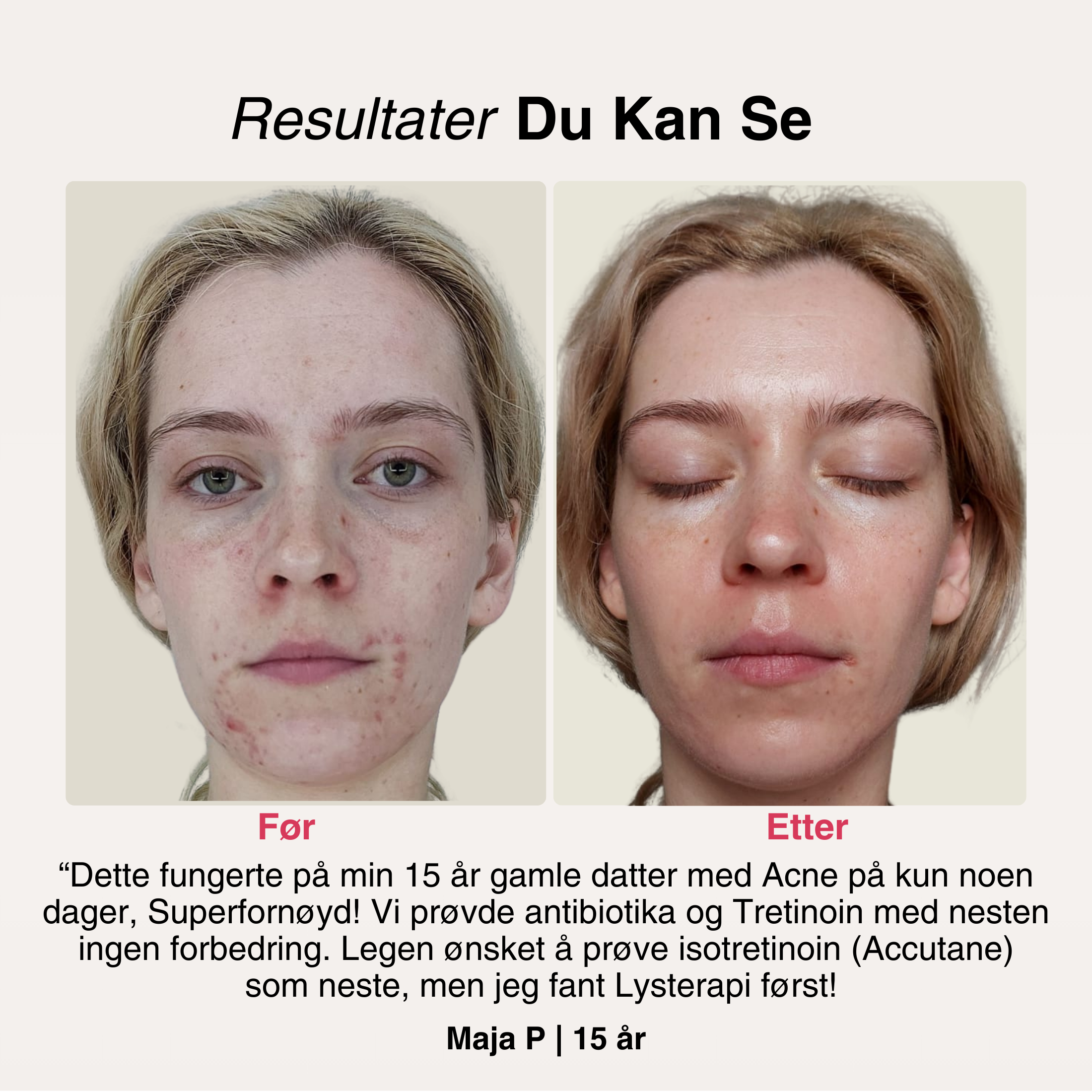 SoftSkin InfraLight® | Ansikt, Hals & Bryst