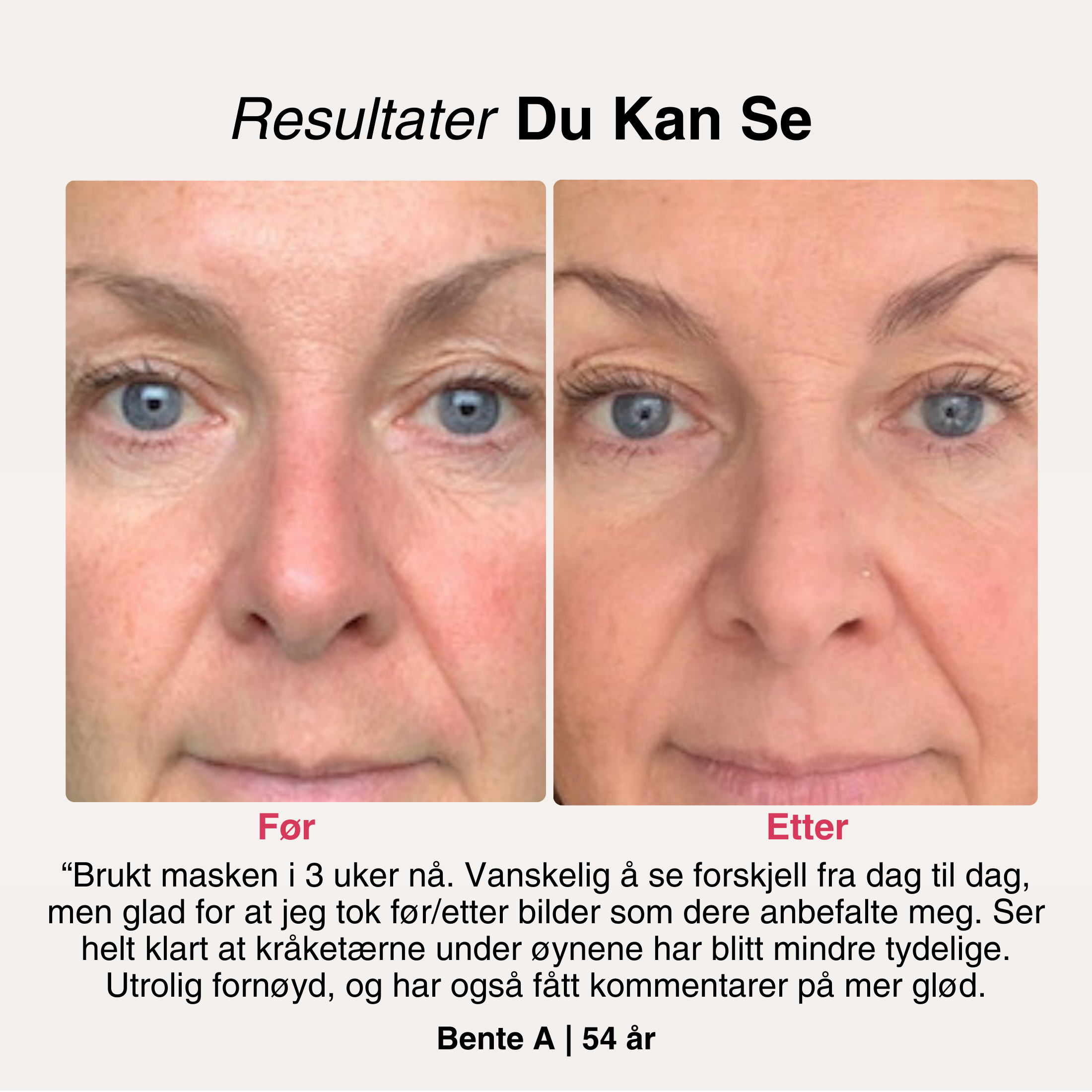 AntiAge-Masken®